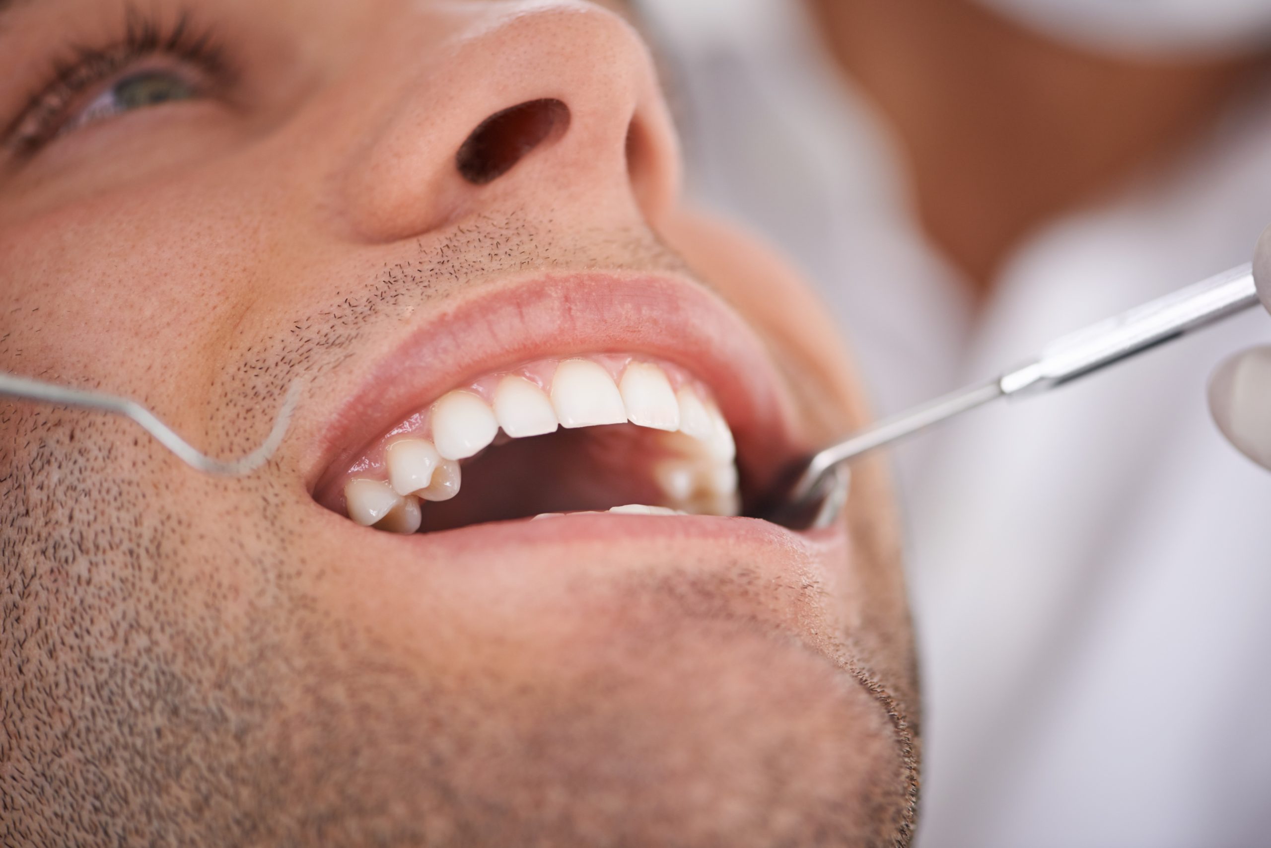 Closeup, man and dentist with tools in mouth for gum disease and oral hygiene with dental inspection. Medical, orthodontics and consultation for teeth health, cleaning and wellness with instrument.