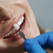 dentist-whiting-teeth-scaled-qsafa2ie6x44kzwezukulae8f20ev4049zn0rugfew